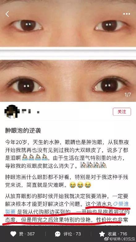 小紅書熱門動(dòng)漫美瞳推薦，瞬間帶你穿越二次元世界！